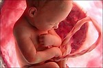 Vyhlásenie trnavského arcibiskupa k snahám o legislatívnu zmenu potratového zákona